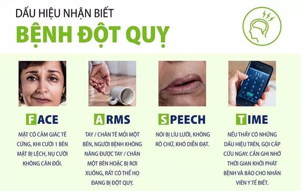 Dấu hiệu nhận biết đột quỵ F.A.S.T (Ảnh: Internet).