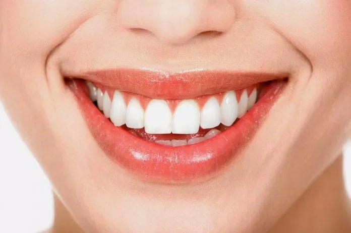 Răng bị sâu ở giai đoạn đầu có thể trông hoàn toàn bình thường (Ảnh: Internet).