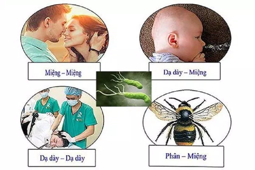 Những đường lây của vi khuẩn HP, trong đó miệng-miệng là thường gặp nhất (Nguồn: Internet). Những đường lây của vi khuẩn HP, trong đó miệng-miệng là thường gặp nhất (Nguồn: Internet).