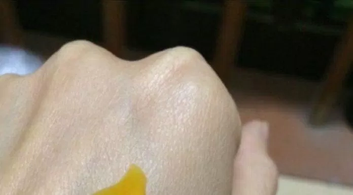 Dạng gel màu cam của sản phẩm Gel nghệ nano trị mụn Decumar (Ảnh: ngquynhvy).
