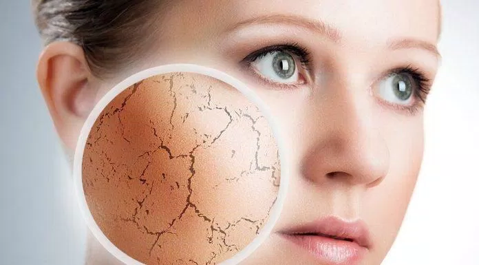 Nếu không cẩn thận làn da sẽ dễ gặp kích ứng khi mới dùng retinol (Nguồn: Internet).