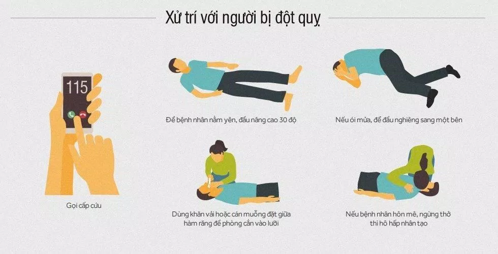Xử trí đúng cách tại chỗ sẽ giúp tăng khả năng điều trị đột quỵ thành công (Ảnh: Internet).