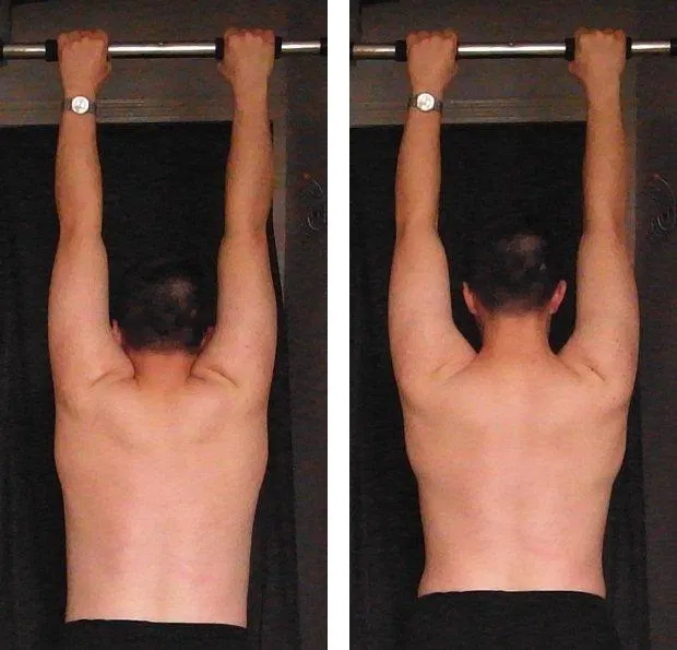 Sự khác biệt khi siết xương bả vai (bên phải) so với thả lỏng hoàn toàn (Ảnh: Internet). Sự khác biệt khi siết xương bả vai (bên phải) so với thả lỏng hoàn toàn (Ảnh: Internet).