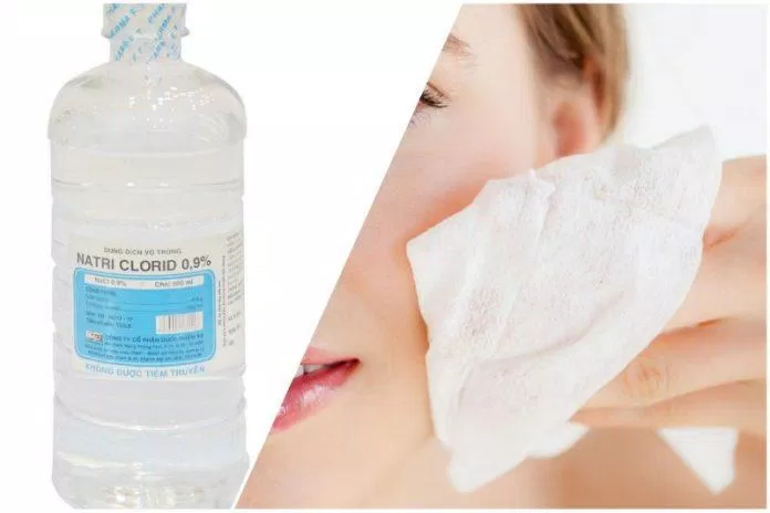 Làm sạch da bằng nước muối sinh lý (Nguồn: Internet)