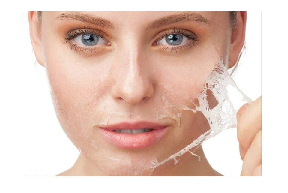 Peel da trở thành xu hướng làm đẹp được yêu thích (Nguồn: Internet)