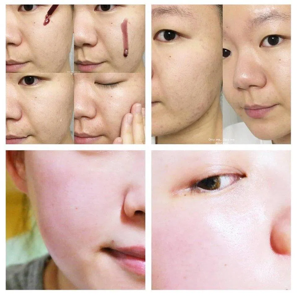 Peel nông dễ dàng thực hiện tại nhà (Nguồn: Internet) Peel nông dễ dàng thực hiện tại nhà (Nguồn: Internet)