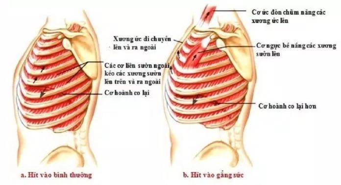 Hoạt động của các cơ có sự khác biệt giữa hít thở bình thường và hít thở gắng sức (Ảnh: Internet). Hoạt động của các cơ có sự khác biệt giữa hít thở bình thường và hít thở gắng sức (Ảnh: Internet).