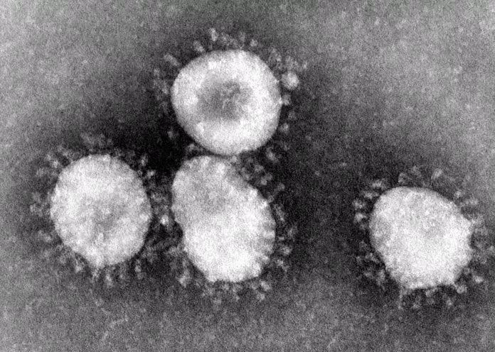 Hình ảnh virus SARS-CoV-2 dưới kính hiển vi có "vương miện" bao quanh (Ảnh: Internet).
