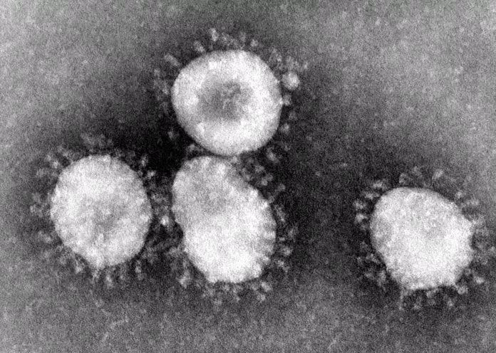 Hình ảnh virus SARS-CoV-2 dưới kính hiển vi có "vương miện" bao quanh (Ảnh: Internet). Hình ảnh virus SARS-CoV-2 dưới kính hiển vi có "vương miện" bao quanh (Ảnh: Internet).