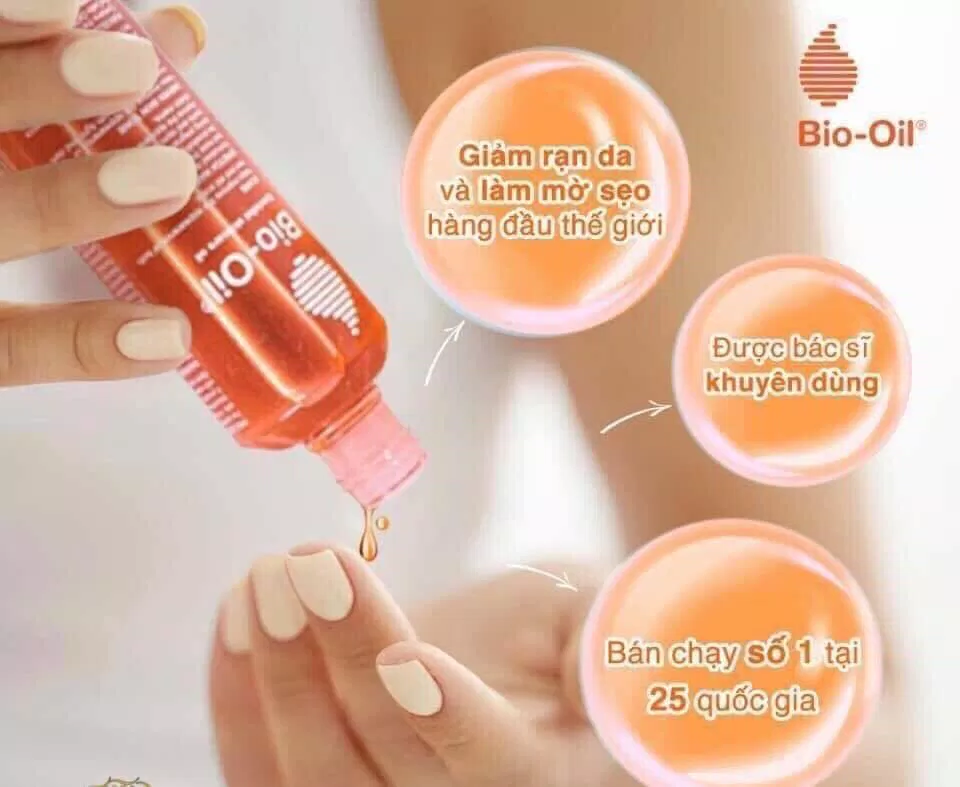Dầu Bio Oil mang lại nhiều công dụng nổi bật như điều trị rạn da, sẹo, cấp ẩm ( Nguồn: internet)