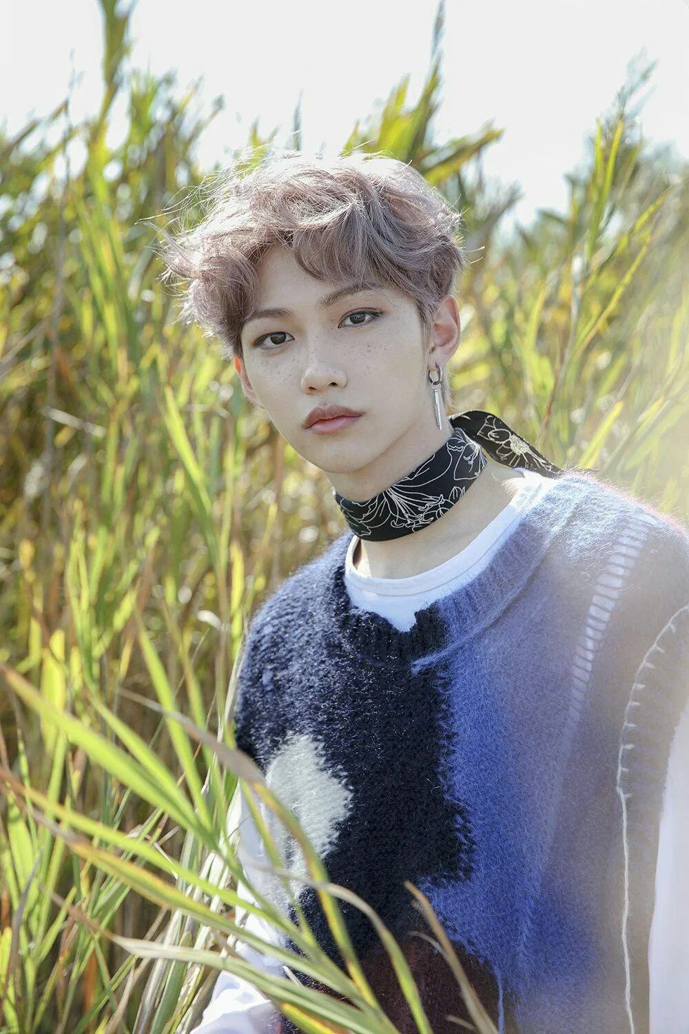 Felix với những đốm tàn nhang đáng yêu. (Nguồn: Internet)