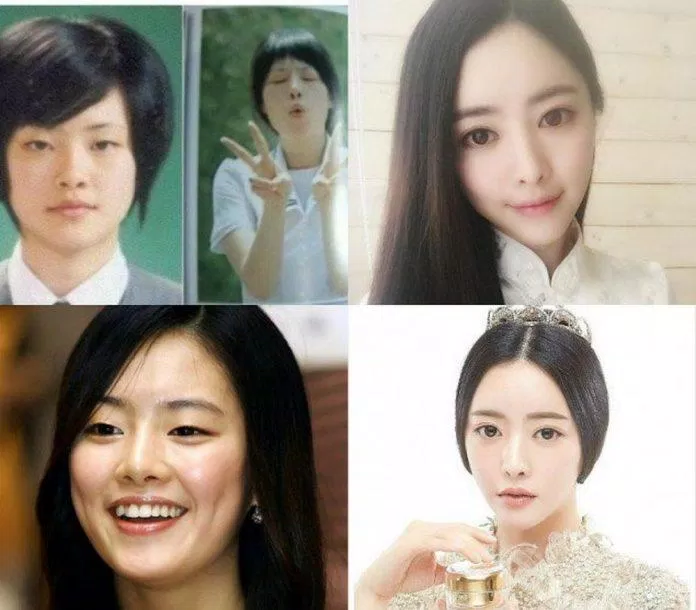 Sự thay đổi trước và sau phẫu thuật thẩm mỹ của Hong Soo Ah (Ảnh: Internet)