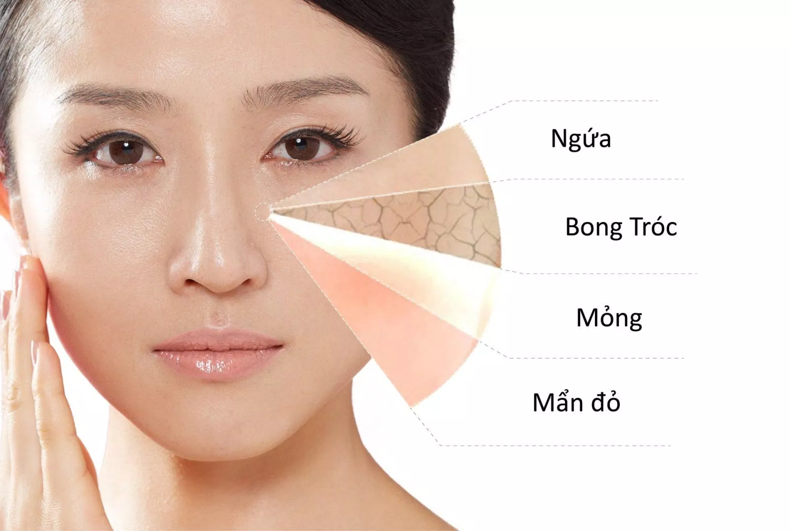 Một số biểu hiện của làn da khô, mất nước hay gặp. (Ảnh: Internet)