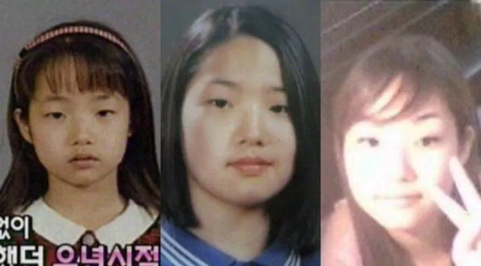 Những hình ảnh của Park Min Young trước khi phẫu thuật thẩm mỹ (Ảnh: Internet)