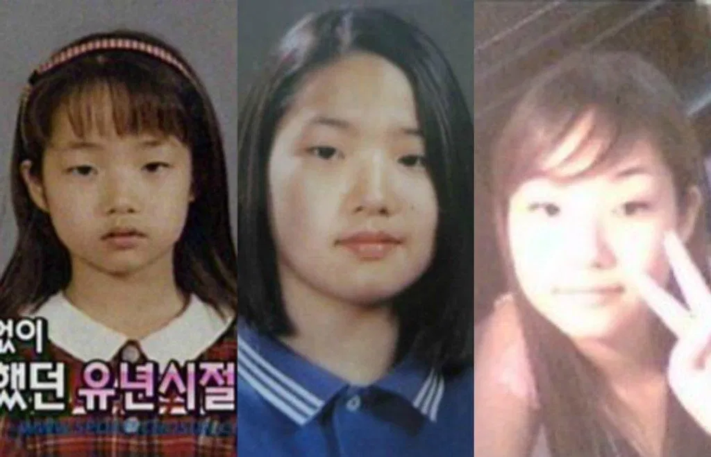 Những hình ảnh của Park Min Young trước khi phẫu thuật thẩm mỹ (Ảnh: Internet)