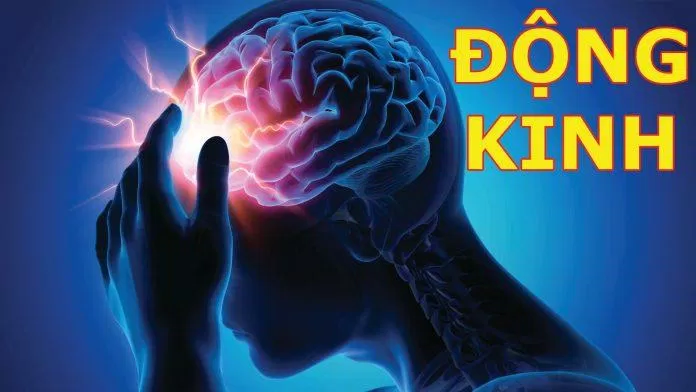 Bệnh động kinh là tình trạng bất thường của não bộ nhưng có nhiều điểm khác biệt so với bệnh tâm thần (Ảnh: Internet). Bệnh động kinh là tình trạng bất thường của não bộ nhưng có nhiều điểm khác biệt so với bệnh tâm thần (Ảnh: Internet).