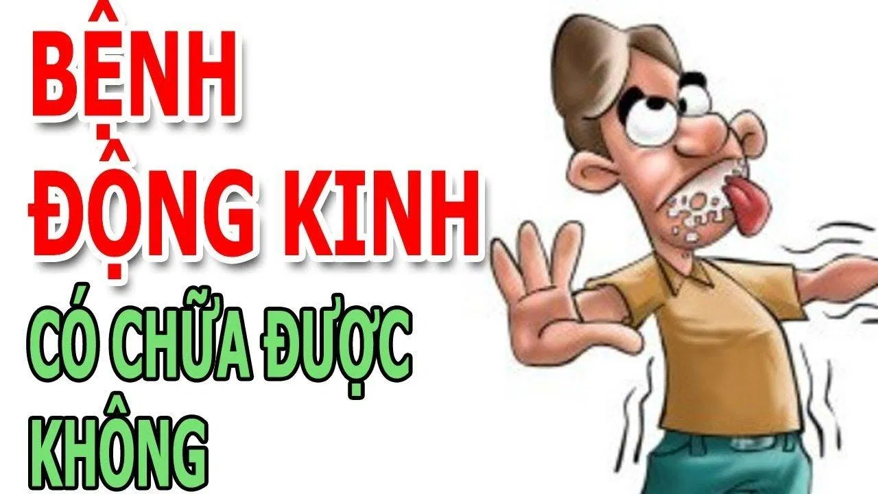 Nhiều người cho rằng động kinh là nỗi ám ảnh suốt đời không thể chữa khỏi, liệu có đúng không? (Ảnh: Internet). Nhiều người cho rằng động kinh là nỗi ám ảnh suốt đời không thể chữa khỏi, liệu có đúng không? (Ảnh: Internet).