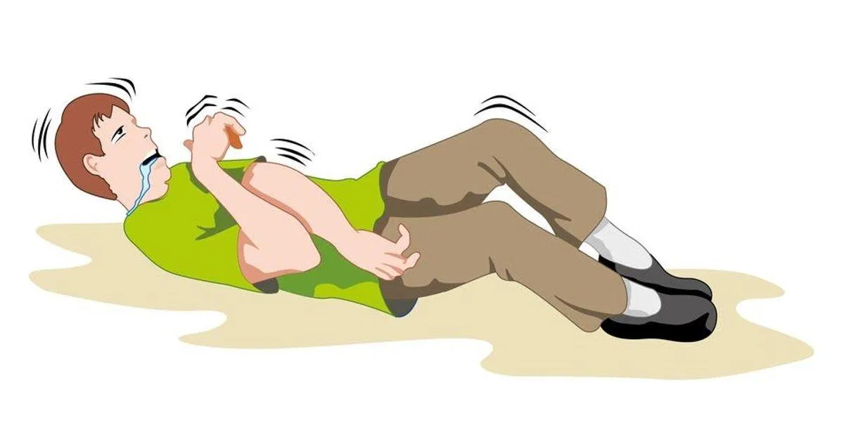 Khái niệm "động kinh" thường bị gắn liền với "co giật", nhưng đó có phải là tất cả? (Ảnh: Internet). Khái niệm "động kinh" thường bị gắn liền với "co giật", nhưng đó có phải là tất cả? (Ảnh: Internet).