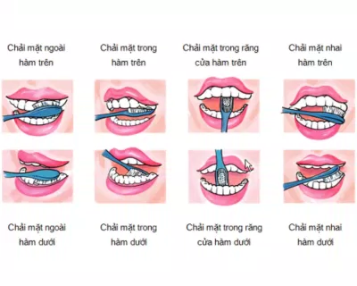 Đánh răng trong khoảng 2 - 3 phút để làm sạch hoàn toàn răng của bạn. (Nguồn: Internet) Đánh răng trong khoảng 2 - 3 phút để làm sạch hoàn toàn răng của bạn. (Nguồn: Internet)