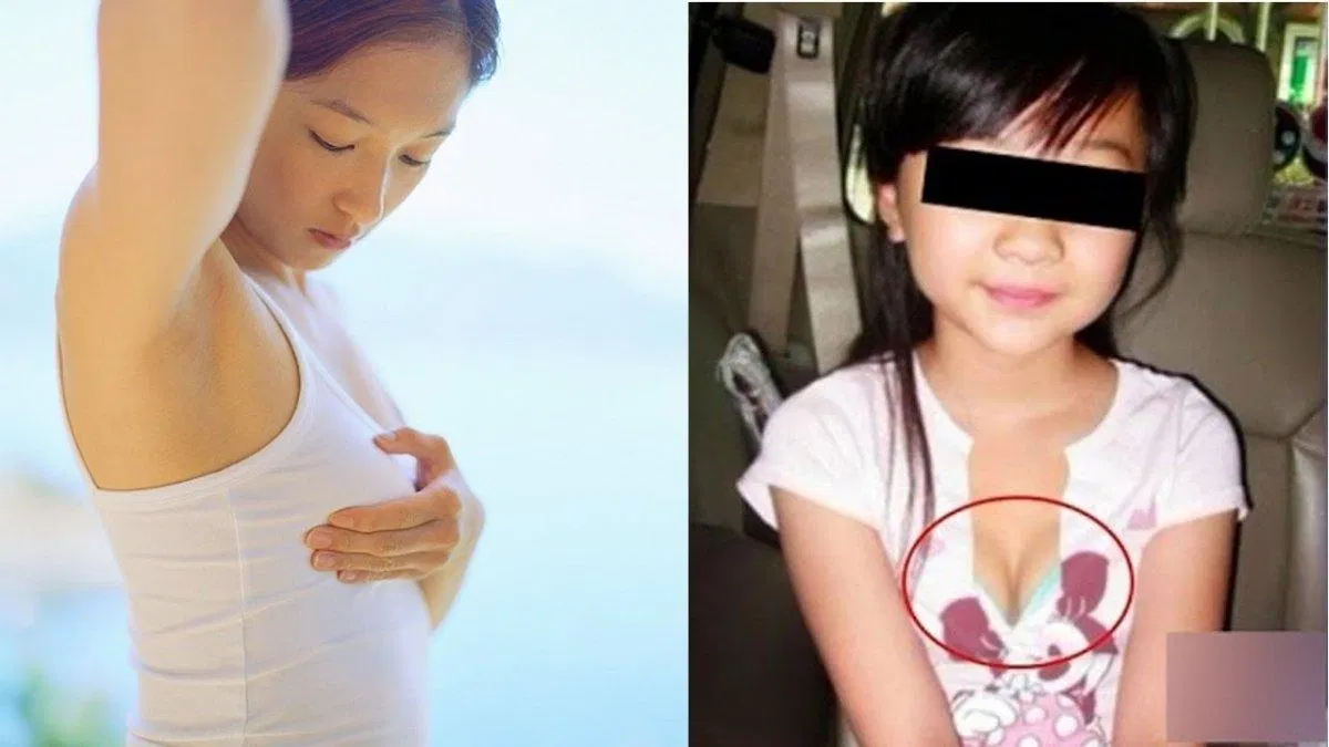 Cơ chế gây dậy thì sớm là do rối loạn các hormone sinh dục trong cơ thể (Ảnh: Internet). Cơ chế gây dậy thì sớm là do rối loạn các hormone sinh dục trong cơ thể (Ảnh: Internet).