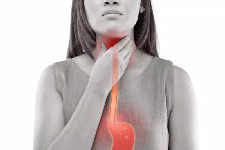 Ợ nóng và trào ngược dạ dày thực quản là vấn đề thường gặp của nhiều người hiện nay (Ảnh: Internet). Ợ nóng và trào ngược dạ dày thực quản là vấn đề thường gặp của nhiều người hiện nay (Ảnh: Internet).
