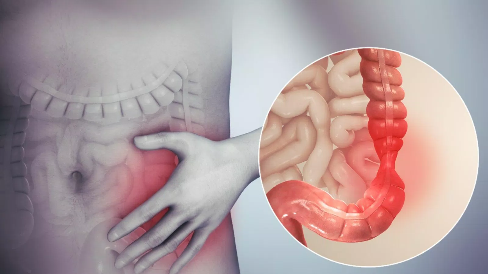 Hội chứng này làm thay đổi thói quen đại tiện, có thể là táo bón, tiêu chảy hoặc xen kẽ cả hai (Ảnh: Internet). Hội chứng này làm thay đổi thói quen đại tiện, có thể là táo bón, tiêu chảy hoặc xen kẽ cả hai (Ảnh: Internet).