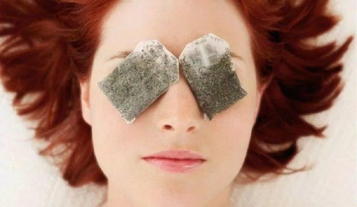 Đắp túi trà lên mắt là cách được nhiều người áp dụng để giảm bọng mắt (Ảnh: Internet).