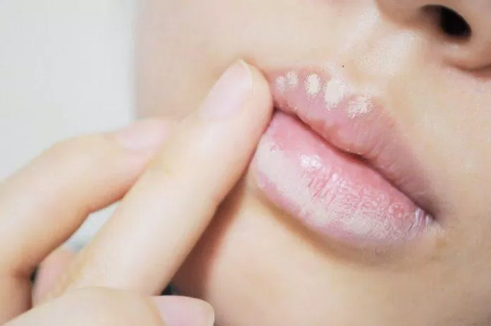Cách tốt nhất để che đi viền môi thâm là che khuyết điểm (Nguồn: Internet) Cách tốt nhất để che đi viền môi thâm là che khuyết điểm (Nguồn: Internet)