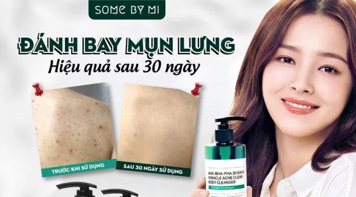 Some By Mi là thương hiệu mỹ phẩm nổi tiếng đến từ Hàn Quốc ( Nguồn: internet)