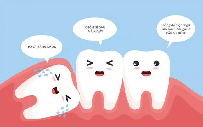 Răng khôn mọc lệch làm các răng khác bị xô đẩy (Ảnh: Internet).