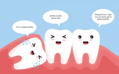 Răng khôn mọc lệch làm các răng khác bị xô đẩy (Ảnh: Internet). Răng khôn mọc lệch làm các răng khác bị xô đẩy (Ảnh: Internet).
