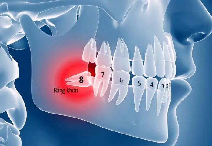 Răng khôn nằm ở vị trí sâu nhất trên khung xương hàm của chúng ta (Ảnh: Internet).