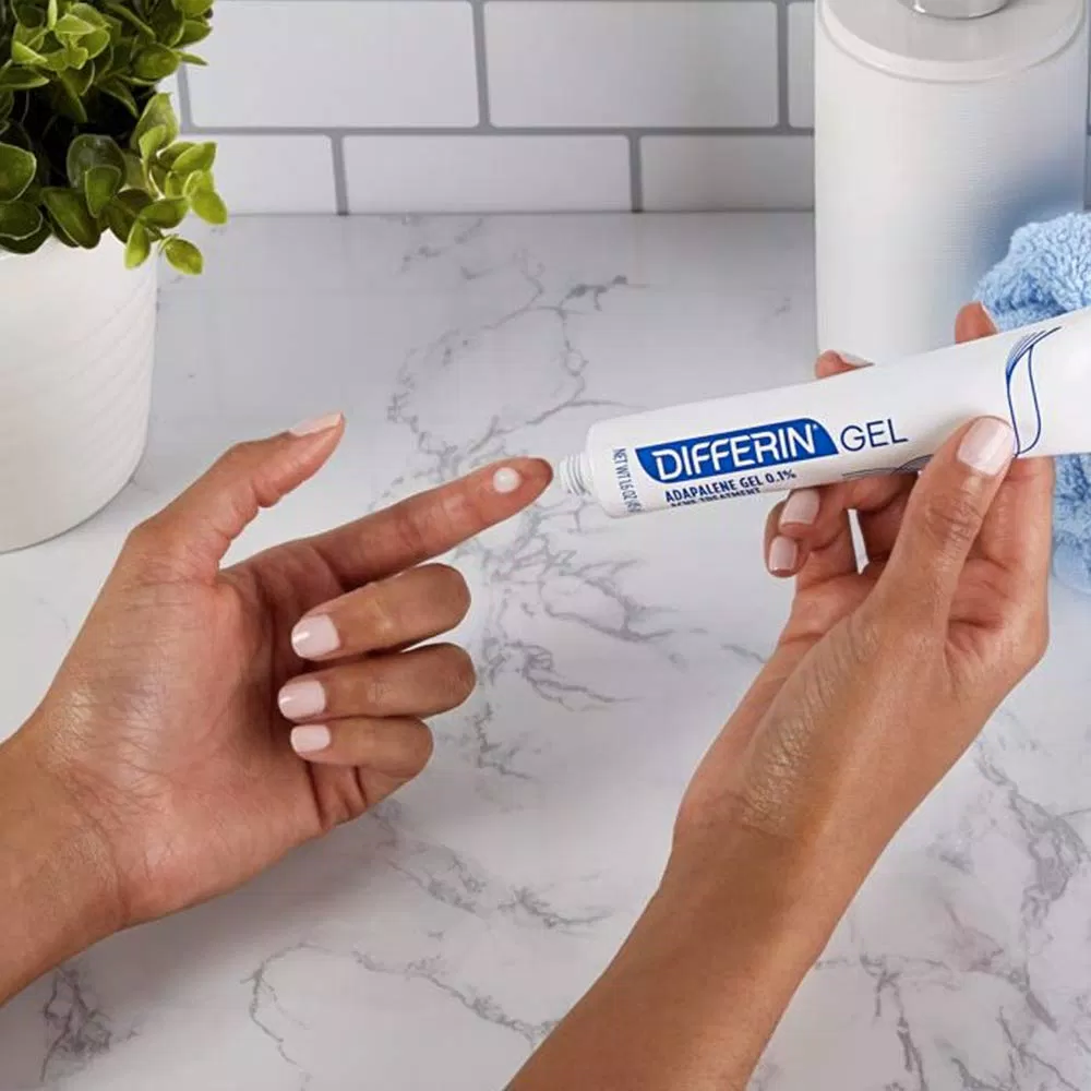 Differin Adapalene Gel 0,1% Acne Treatment có khả năng kháng viêm tiêu sưng cực tốt (Nguồn: Internet) Differin Adapalene Gel 0,1% Acne Treatment có khả năng kháng viêm tiêu sưng cực tốt (Nguồn: Internet)