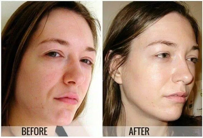 Serum Skinceuticals Vitamin CE Ferulic được nhiều người tin tưởng (Nguồn: Internet) Serum Skinceuticals Vitamin CE Ferulic được nhiều người tin tưởng (Nguồn: Internet)