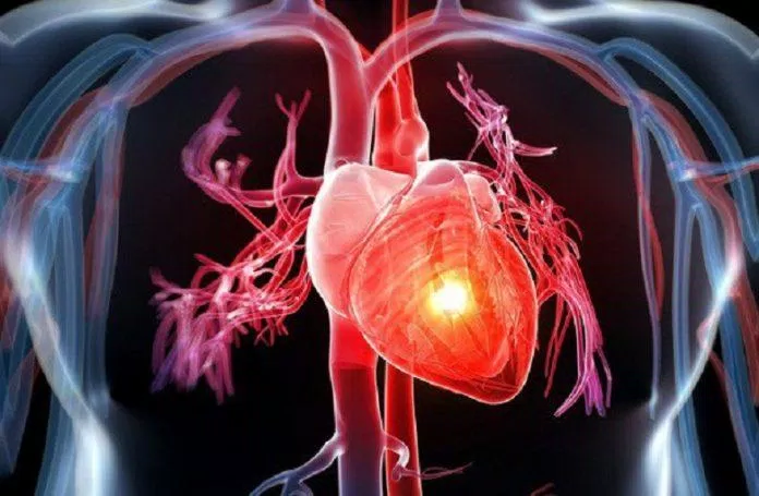 COPD cũng ảnh hưởng đến tim mạch (Ảnh: Internet).