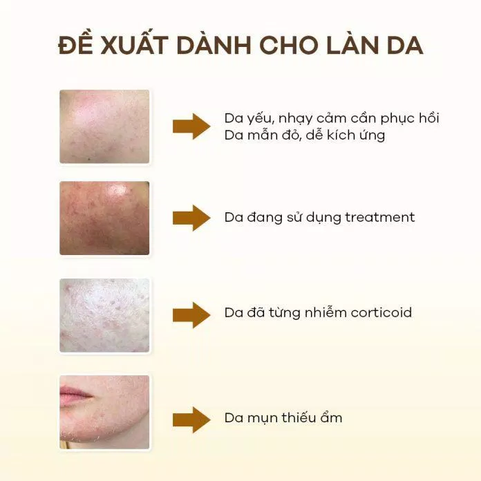 Sản phẩm đặc biệt dành cho da đang treatment.