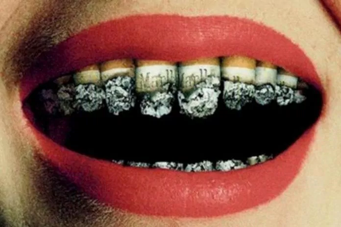 Thuốc lá sẽ hủy hoại răng miệng của chúng ta (Ảnh: Internet).