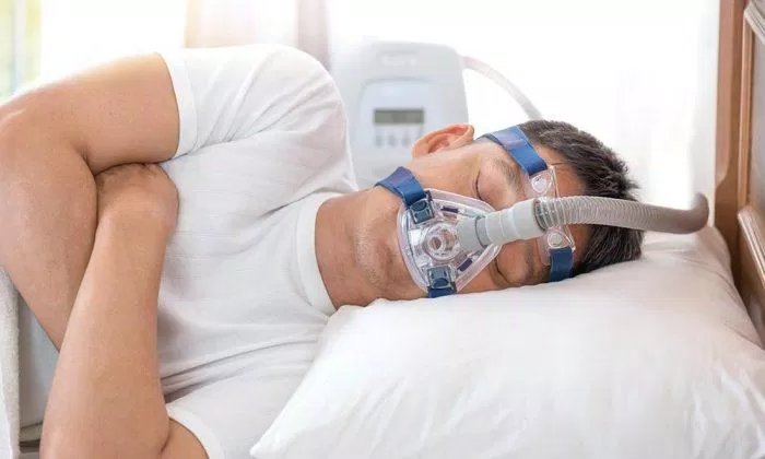 Máy thở CPAP dùng để điều trị hội chứng ngưng thở khi ngủ do tắc nghẽn (Ảnh: Internet).