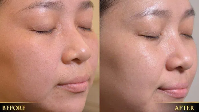 Tinh chất French Beauty Active Rejuvenation có thể cải thiện làn da không đều màu hiệu quả (Nguồn: Internet).