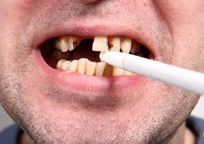 Hãy bỏ thuốc lá ngay hôm nay! (Ảnh: Internet). Hãy bỏ thuốc lá ngay hôm nay! (Ảnh: Internet).