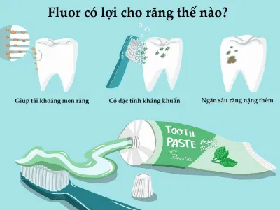 Fluor có nhiều tác dụng trong việc bảo vệ răng (Ảnh: Internet). Fluor có nhiều tác dụng trong việc bảo vệ răng (Ảnh: Internet).