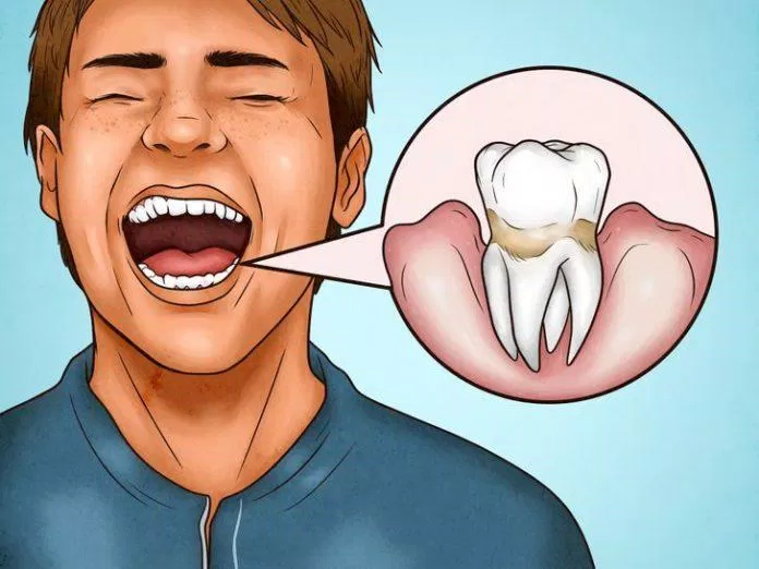 Phần răng gần lợi có thể cho chúng ta biết mình có đánh răng đúng cách không đấy (Ảnh: Internet)