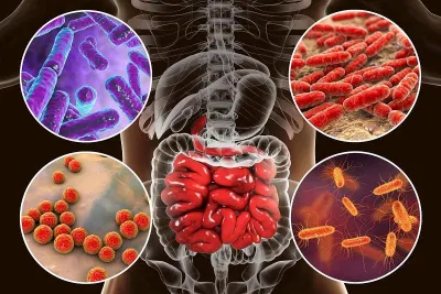 E. coli là một trong số rất nhiều loại vi khuẩn sống trong ruột của chúng ta (Ảnh: Internet). E. coli là một trong số rất nhiều loại vi khuẩn sống trong ruột của chúng ta (Ảnh: Internet).