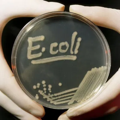 Cấy mẫu phân để tìm vi khuẩn E. coli (Ảnh: Internet). Cấy mẫu phân để tìm vi khuẩn E. coli (Ảnh: Internet).