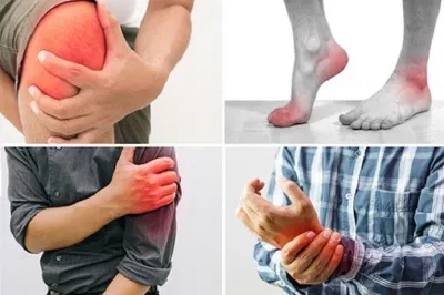 Các khớp có thể bị viêm và đau do phản ứng với nhiễm khuẩn (Ảnh: Internet). Các khớp có thể bị viêm và đau do phản ứng với nhiễm khuẩn (Ảnh: Internet).