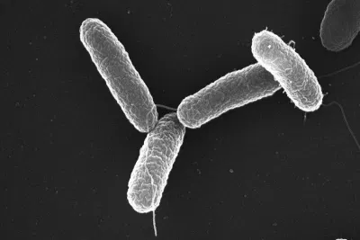 Vi khuẩn Salmonella là thủ phạm thường xuyên gây ra nhiều đợt ngộ độc thực phẩm (Ảnh: Internet). Vi khuẩn Salmonella là thủ phạm thường xuyên gây ra nhiều đợt ngộ độc thực phẩm (Ảnh: Internet).