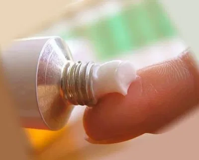 Thuốc mỡ bôi da giúp giảm bớt triệu chứng (Ảnh: Internet). Thuốc mỡ bôi da giúp giảm bớt triệu chứng (Ảnh: Internet).