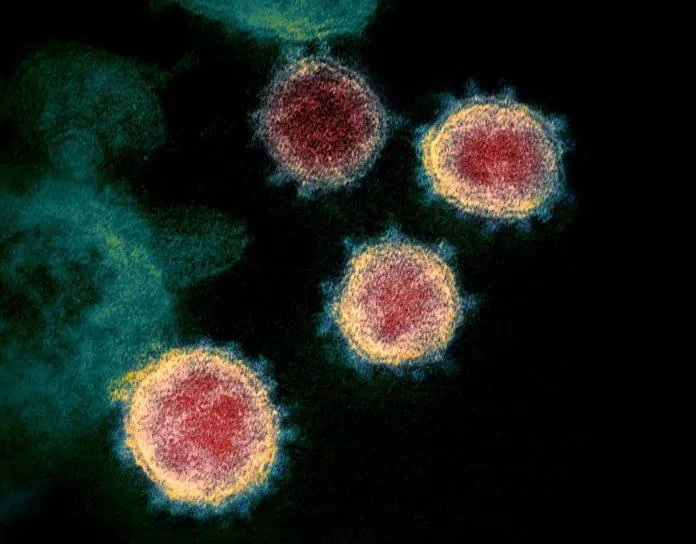 Ảnh chụp virus SARSS-CoV-2 qua kính hiển vi điện tử (Ảnh: Internet).