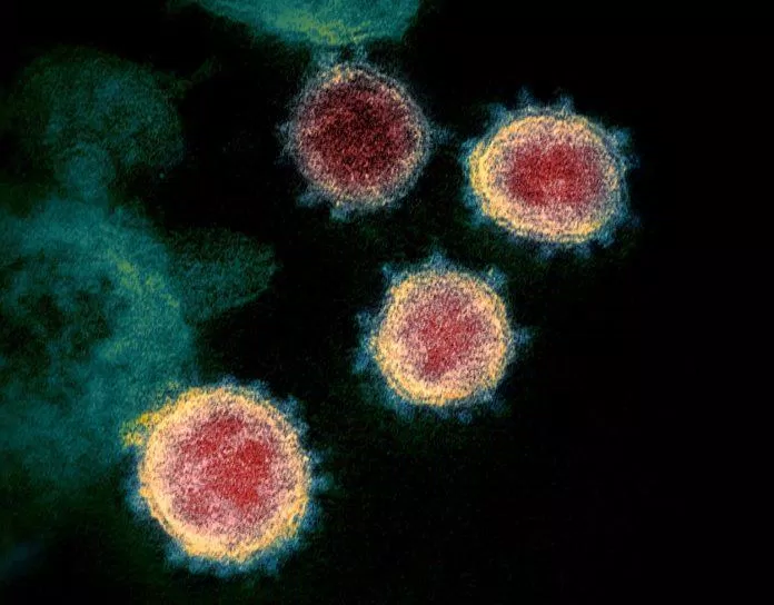 Ảnh chụp virus SARSS-CoV-2 qua kính hiển vi điện tử (Ảnh: Internet). Ảnh chụp virus SARSS-CoV-2 qua kính hiển vi điện tử (Ảnh: Internet).