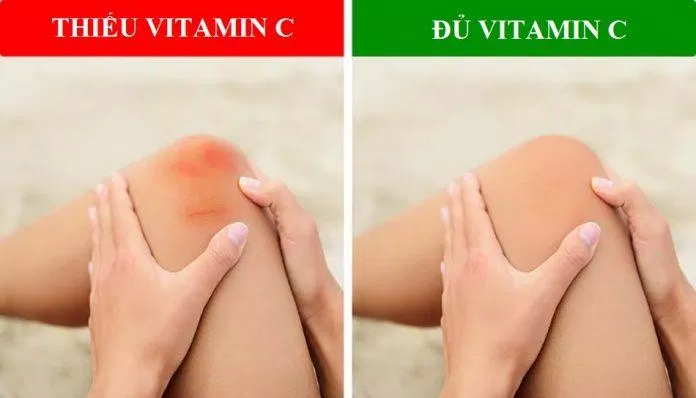 Vitamin C có vai trò quan trọng đối với các vết thương trên cơ thể (Ảnh: Internet).